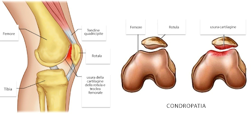 patella