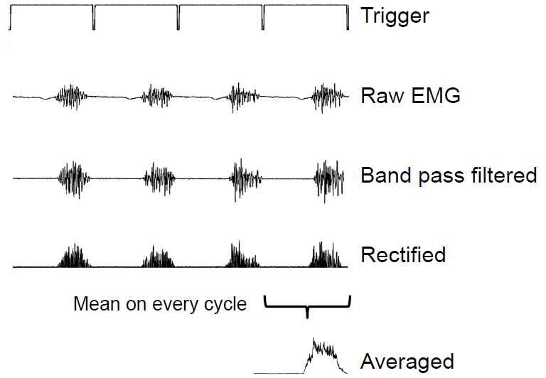 emg